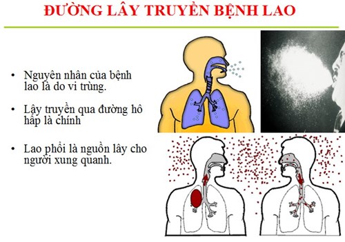 Kiến thức truyền thông chống lao trong trường học